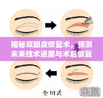 双眼皮修复术揭秘,未来技术进展与术后恢复体验展望