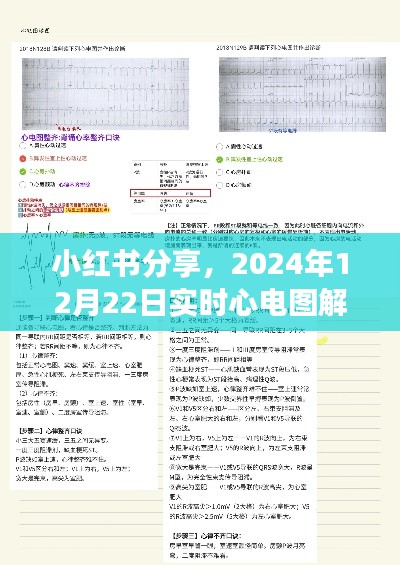 小红书分享,掌握脉搏健康秘籍——实时心电图解读(日期标注)